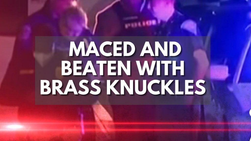 Maced, Beaten With Brass Knuckles