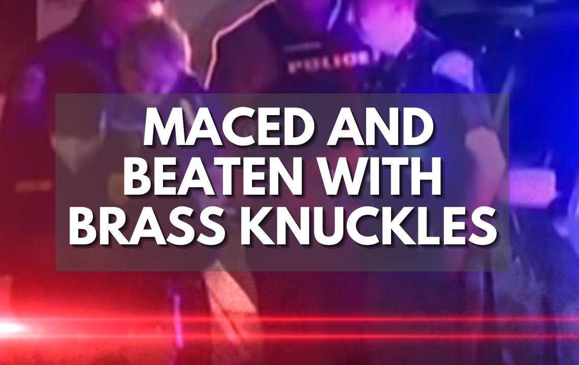 Maced, Beaten With Brass Knuckles