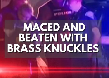 Maced, Beaten With Brass Knuckles