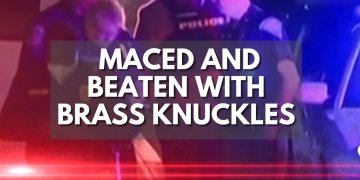Maced, Beaten With Brass Knuckles