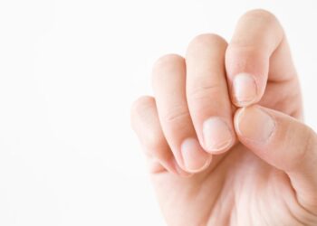 A person positioning their fingers to show the viewer the kinds of damage across all of their nail surfaces.