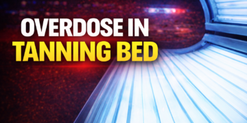 OVERDOSE IN TANNING BED